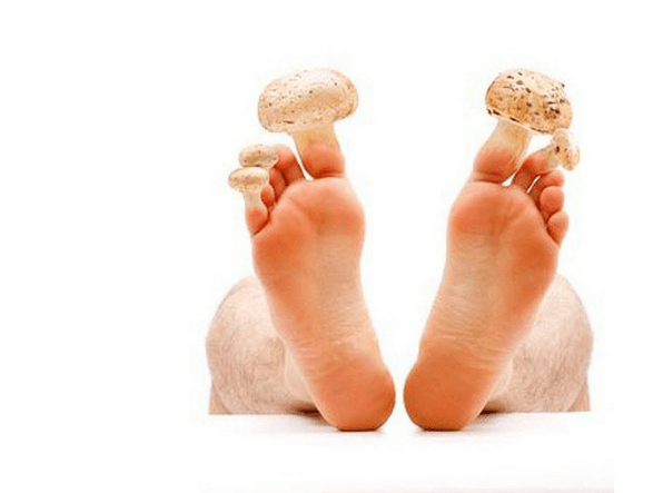 rimedio naturale funghi piedi